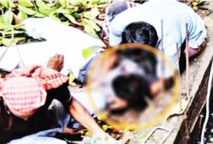 নির্মাণ শ্রমিকের মাথা ফুঁড়ে বেরিয়ে গেল রড