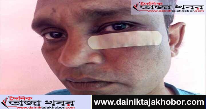 বগুড়ায় যুবলীগ ও ছাত্রলীগ নেতাকে মারধরের অভিযোগঃ দৈনিক তাজা খবর। 